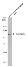 Anti-Autotaxin antibody used in Western Blot (WB). GTX114627